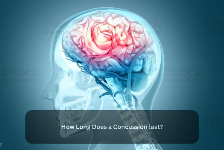 How Long Does a Concussion last?